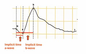 Классическая кривая электроретинограммы