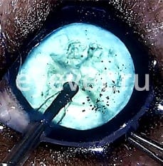 операция катаракты у собаки