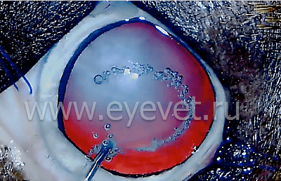 этап операции по ультразвуковому удалению врождённой катаракты у собаки - удаление стекловидного тела из передней камеры