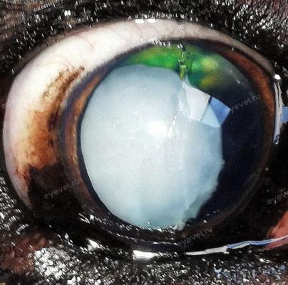 Отрыв связок хрусталика, перезрелая катаракта у собаки