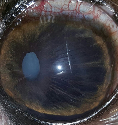 Глаукома у собаки с катарактой