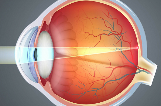 катаракта у животных: ультразвуковая факоэмульсификация с имплантацией искусственного хрусталика и медикаментозная профилактика
