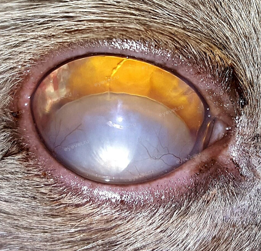 Зрелая катаракта, Люксация хрусталика в ПКГ у кошки. Mature cataract, lens luxation in PCG in a cat