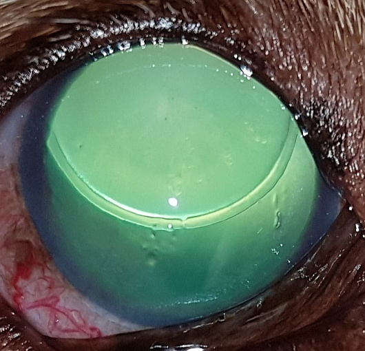 Люксация хрусталика в заднюю камеру глаза, вторичная глаукома у собаки. Lens luxation in the posterior chamber of the eye, secondary glaucoma in a dog