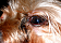 Так выглядит острый гнойный коньюктивит у собаки. Глазное яблоко раздражено, воспалено , гиперемировано. В углу глаза обильные гнойные выделения с обширными корками на веках. Йорк 5лет. Развившийся стрептококковый коньюкттивит.