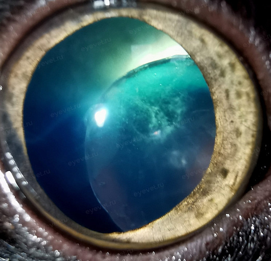 Люксация хрусталика  в заднюю камеру глаза. Luxation of the lens in the posterior chamber of the eye in a cat